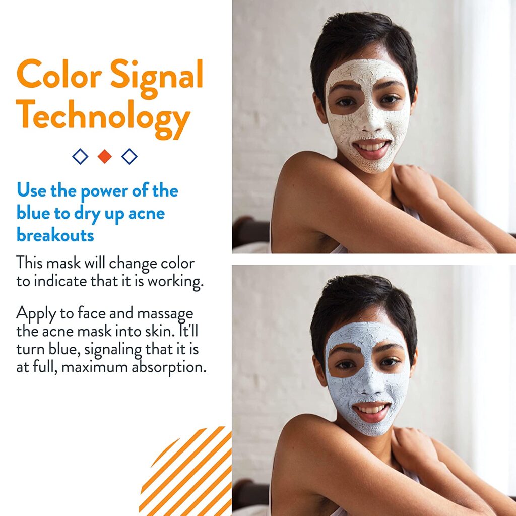 AcneFree Therapeutic Sulfur Mask Acne Treatment UK STOCK