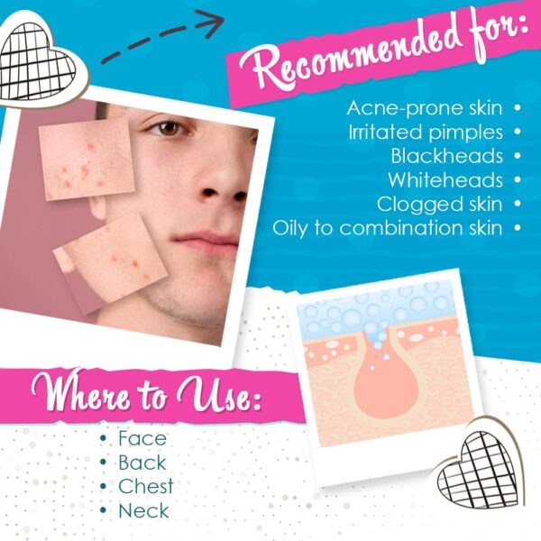 Bye Bye Blemish Acne Drying Lotion, Reduce Pimples Overnight how to use