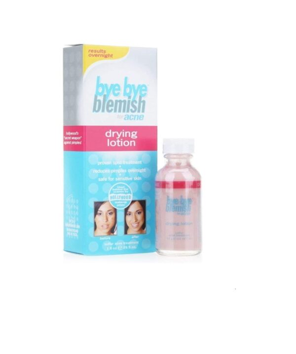 Bye Bye Blemish Acne Drying Lotion, Reduce Pimples Overnight